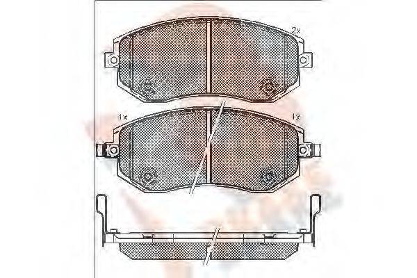 R BRAKE RB1717